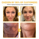 Flysmus™ BeeLift Creme Firmador Anti-Idade – Combate a flacidez e a pele enrugada!