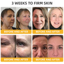 Flysmus™ BeeLift Creme Firmador Anti-Idade – Combate a flacidez e a pele enrugada!