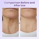 NeckYouth Peptide Adesivo Antirrugas
