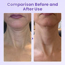 NeckYouth Peptide Adesivo Antirrugas