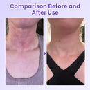 NeckYouth Peptide Adesivo Antirrugas