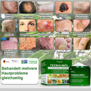 Teebaumol Creme – Remove imperfeições da pele, repara pele danificada, ilumina e neutraliza o envelhecimento