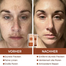 Peeloff Máscara facial