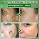 Teebaumol Creme – Remove imperfeições da pele, repara pele danificada, ilumina e neutraliza o envelhecimento