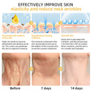 Flysmus™ BeeLift Creme Firmador Anti-Idade – Combate a flacidez e a pele enrugada!