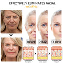 Flysmus™ BeeLift Creme Firmador Anti-Idade – Combate a flacidez e a pele enrugada!