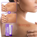 RevivaDerma Gel para Cicatrizes Faciais e Corporais
