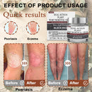 Black Rice Skin Repair Cream ⚕️ (Elimina verrugas e marcas, alivia psoríase, uniformiza a pele e reduz manchas)