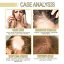 Oleo Natural Hair Growth