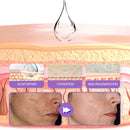 RevivaDerma Gel para Cicatrizes Faciais e Corporais