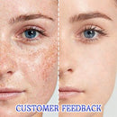 Flawless Creme para manchas