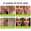 Creme firmador e antirrugas Rolimey® Botox & Vita-A Retinol Shot - Último dia da promoção com 70% de desconto