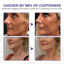 Creme Firmador de Pele Timilk ElastaPro Emu Oil