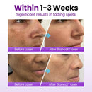 Sérum facial SpotErase com probióticos