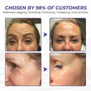 Creme Firmador de Pele Timilk ElastaPro Emu Oil