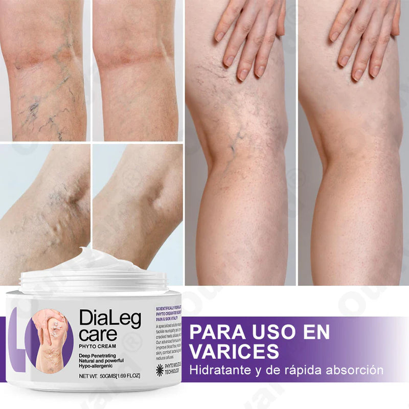 Dialeg Cream