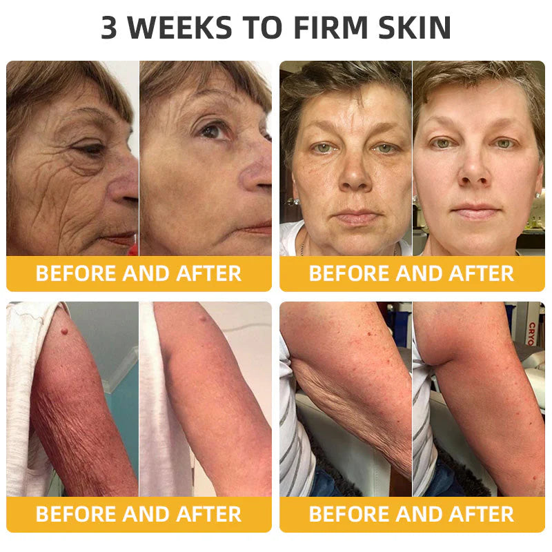 Flysmus™ BeeLift Creme Firmador Anti-Idade – Combate a flacidez e a pele enrugada!