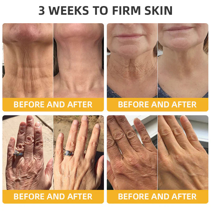 Flysmus™ BeeLift Creme Firmador Anti-Idade – Combate a flacidez e a pele enrugada!