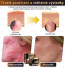 Botox Creme de tratamento antienvelhecimento para a pele