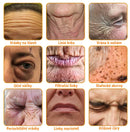 Botox Creme de tratamento antienvelhecimento para a pele