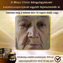 Botox Creme de tratamento antienvelhecimento para a pele