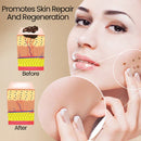 BEEVENON SPRAY PARA REMOÇÃO