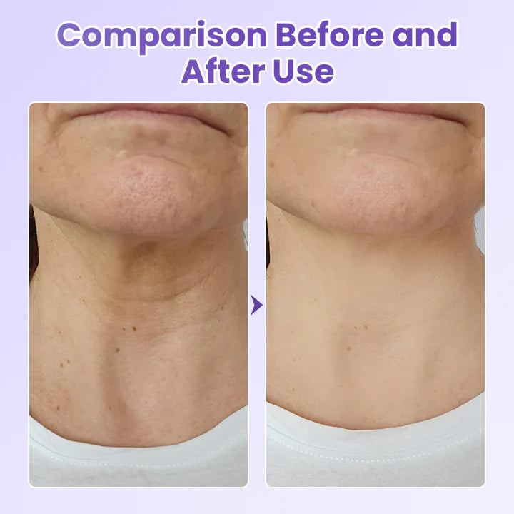 NeckYouth Peptide Adesivo Antirrugas