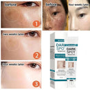 Bloobeac® Creme de Beleza Removedor de Manchas