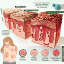 Creme Timilk® DermaPure