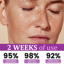 MelantraX Serum anti-hiperpigmentação avançada