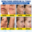 PDRN BELLE® Tratamento Antirrugas com Botox e PDRN – Creme Lifting e Firmador