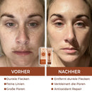 Peeloff Máscara facial