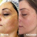 Korean HerbErase - Máscara Facial Peel-Off com Óleo de Semente de Cominho Preto para Manchas Escuras