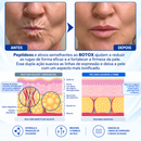 PDRN BELLE® Tratamento Antirrugas com Botox e PDRN – Creme Lifting e Firmador