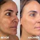 Korean HerbErase - Máscara Facial Peel-Off com Óleo de Semente de Cominho Preto para Manchas Escuras