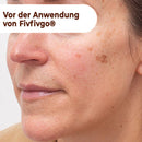 Peeloff Máscara facial