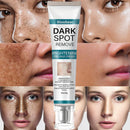 Bloobeac® Creme de Beleza Removedor de Manchas