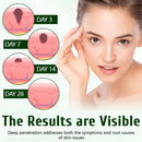 Creme Timilk® DermaPure