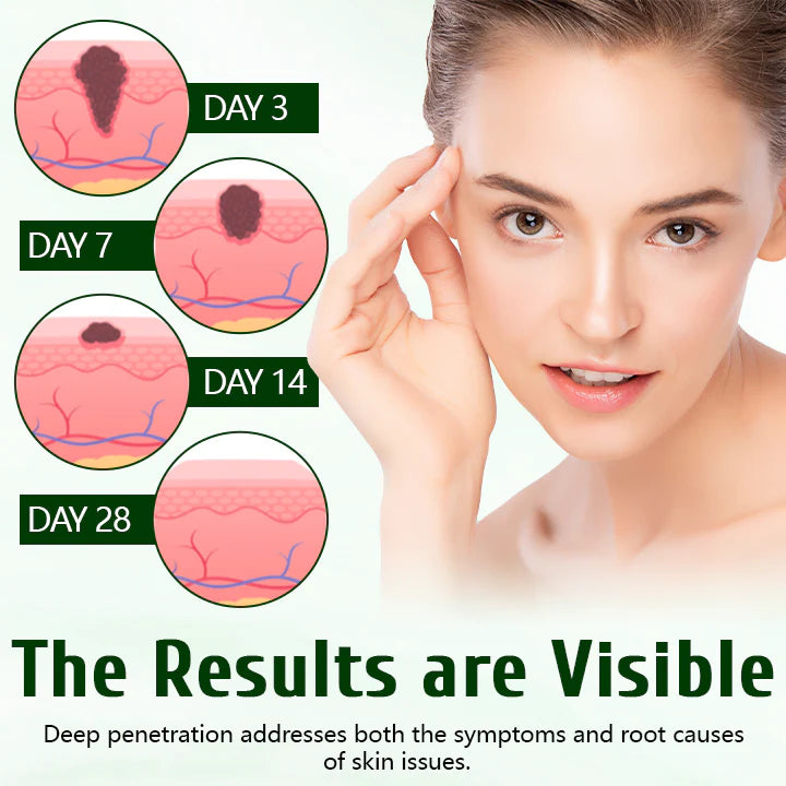 Creme Timilk® DermaPure