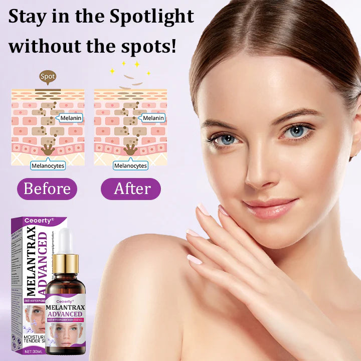 MelantraX Serum anti-hiperpigmentação avançada