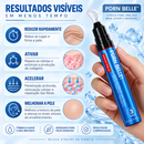 PDRN BELLE® Tratamento Antirrugas com Botox e PDRN – Creme Lifting e Firmador
