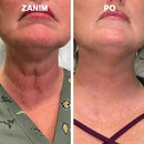 Fbt™ Anti-Aging Firming Serum