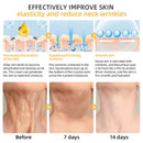 Flysmus™ BeeLift Creme Firmador Anti-Idade – Combate a flacidez e a pele enrugada!
