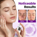 Sérum facial SpotErase com probióticos