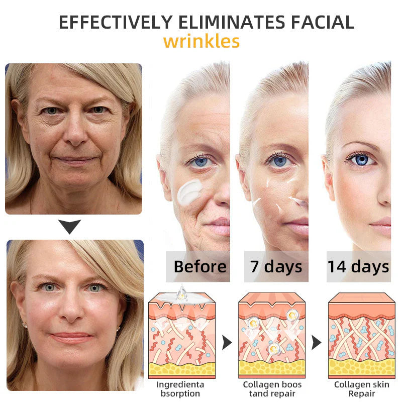 Flysmus™ BeeLift Creme Firmador Anti-Idade – Combate a flacidez e a pele enrugada!