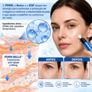 PDRN BELLE® Tratamento Antirrugas com Botox e PDRN – Creme Lifting e Firmador