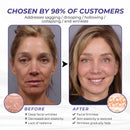 Creme Firmador de Pele Timilk ElastaPro Emu Oil