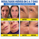 PDRN BELLE® Tratamento Antirrugas com Botox e PDRN – Creme Lifting e Firmador