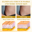 BQYOOM™ ApisPDRN DermoTense Creme Lifting