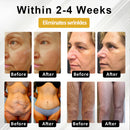 BQYOOM™ ApisPDRN DermoTense Creme Lifting